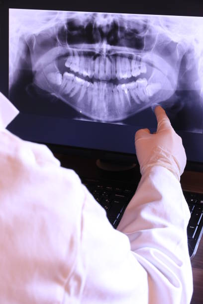 Best Emergency Root Canal Therapy in Ly Lake, IL
